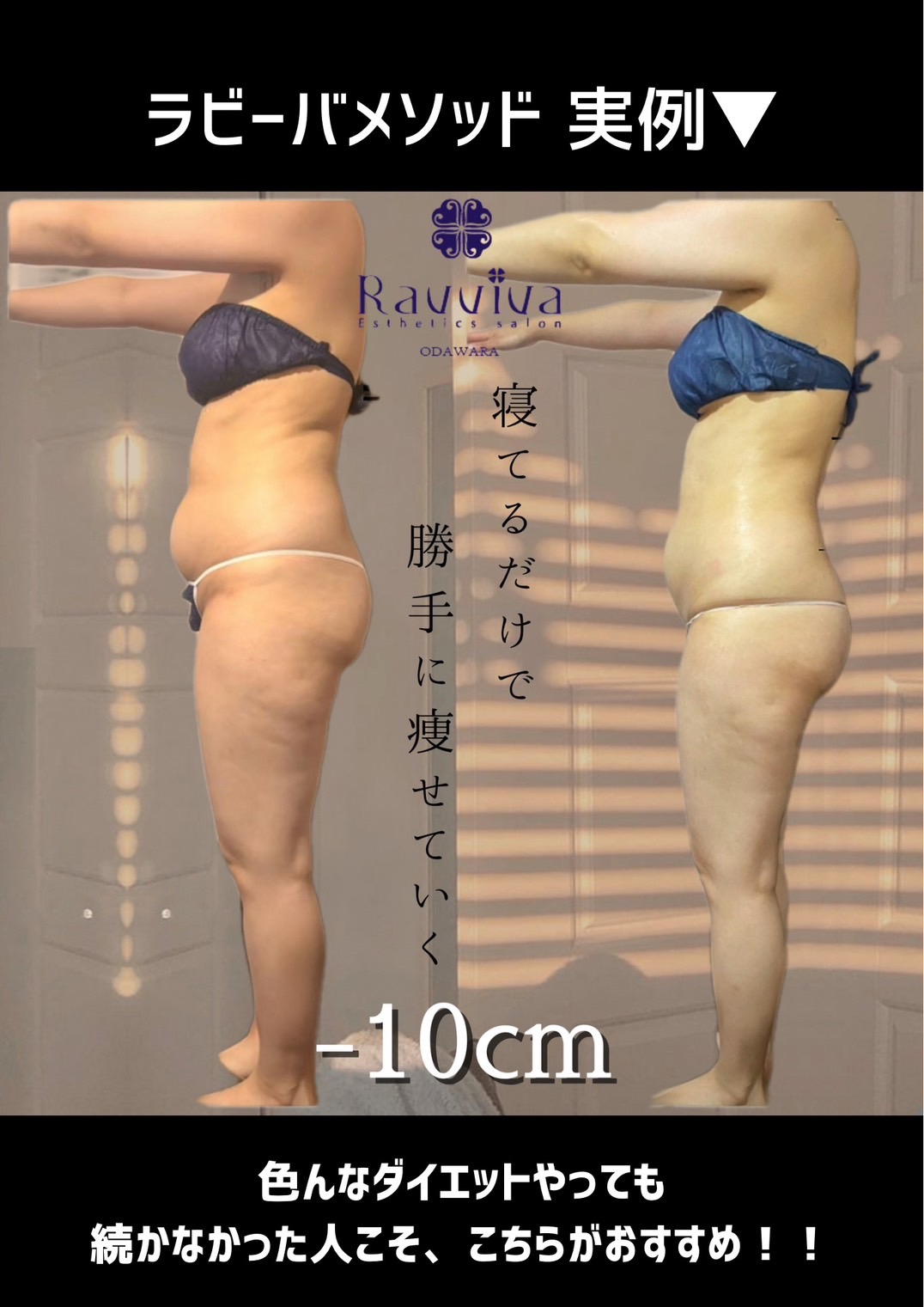 キャンペーン｜Ravviva（ラビーバ）｜神奈川県小田原市鴨宮のエステ